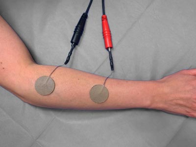 Unterarm eines Patienten mit angebrachten Messkabeln